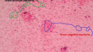 Bile Sample Gram Stain: Introduction, Procedure and Result Interpretation