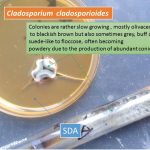 Cladosporium on SDA a dematiaceous fungus