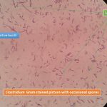 Clostridium gram stain showing gram positive bacilli and also with spores