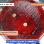 Clostridium on blood agar