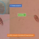 Conidia of Exserohilum