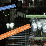 Culture of anaerobic bacteria