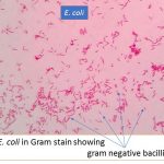 E. coli in gram stain