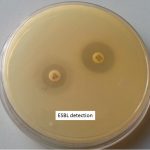 ESBL detection method