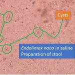 Endolimax nana in saline preparation