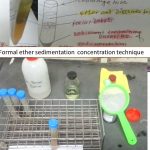 Concentration techniques principle works on specific gravity. By addition of ethyle acetate to formalin fixed sample and subsequent centrifugation, the parasites present are heavier than the solution and settle in the sediment of