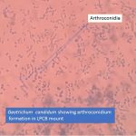Geotrichum candidum showing arthroconidium