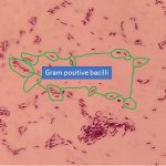 Gram positive bacilli