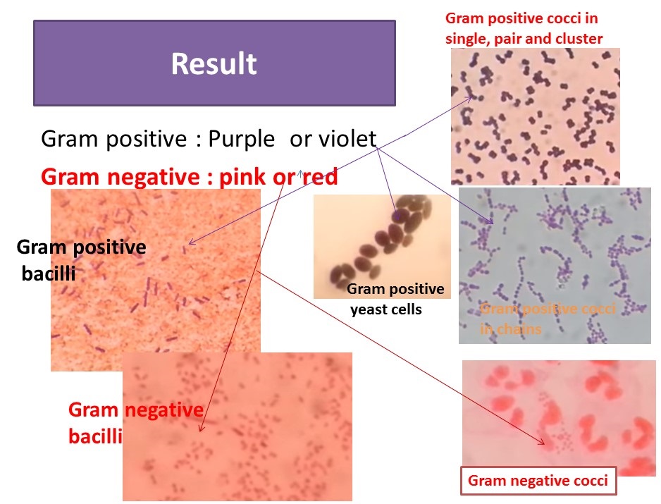 Gram stain result interpretation