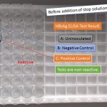 HBsAg ELISA Test Result