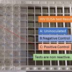 HIV ELISA test result