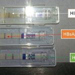 HIV,HBsAg and HCV test positive