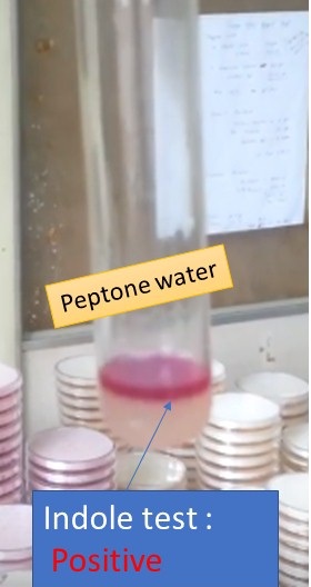 Indole test in peptone water showimg indole test positive