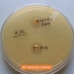 KPC detection method
