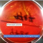 Kingella kingae on blood agar