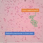 Klebsiella pneumoniae in Gram stain