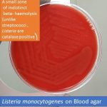 Listeria monocytogenes on Blood agar