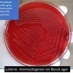Listeria on blood agar and its colony morphology