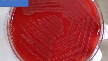 Listeria on blood agar and its colony morphology