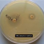 MBL detection method