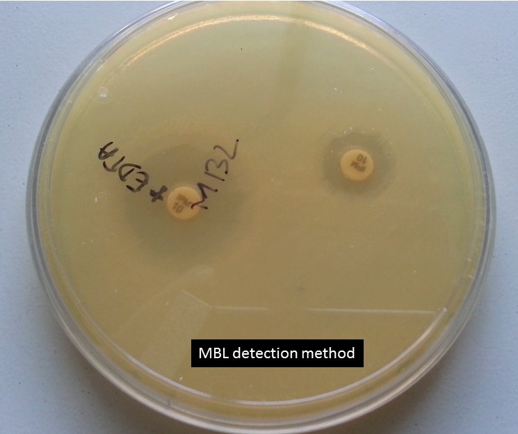 MBL detection method