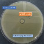 MRSA detection method