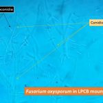 Microconidia and conidiophores of Fusarium in LPCB