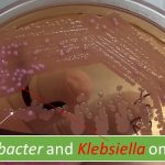 Hospital acquired infection