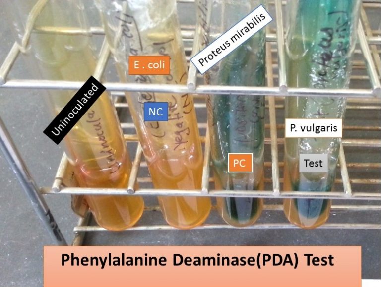 Phenylalanine Deaminase test Principle, procedure, result interpretation
