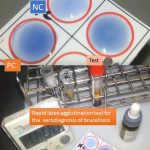 Rapid latex agglutination test for brucellosis