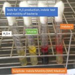 SIM test for hydrogen sulphide , indole production and motility test for gram negative bacteria