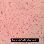 Salmonella Typhi in Gram stain