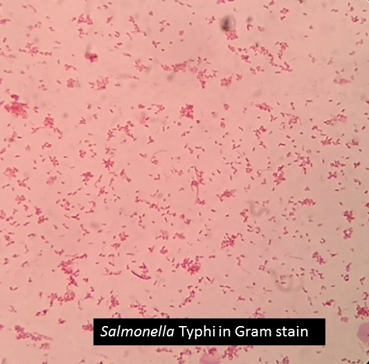 Salmonella Typhi in Gram stain