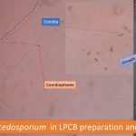 Scedosporium in LPCB preparation and on SDA