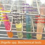 Shigella biochemical tests