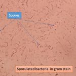 Sporulated bacteria in gram stain