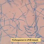 Trichosporon LPCB preparation