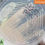 Trichosporon on PDA