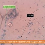 conidia and conidiophores of Cladosporium in LPCB mountconidia and conidiophores of Cladosporium in LPCB mount