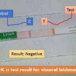 rK39 test result for visceral leishmaniasis