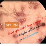 sperm under microscope during semen analysis