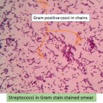 streptococci in gram stain showing gram positive cocci in chains