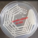 Candida albicans on SDA