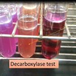 Decarboxylase test