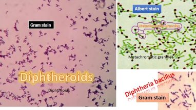 Diphtheria bacillus versus Diphtheroids