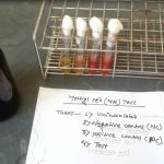 Methyl red test