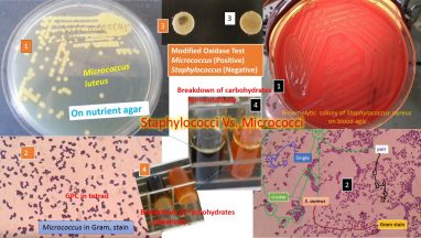 Staphylococcus versus Micrococcus