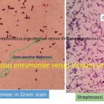 Streptococcus pneumoniae versus Viridans streptococci