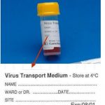 Viral Transport Medium: Introduction, Composition, Use and Function