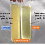 Bile solubility test